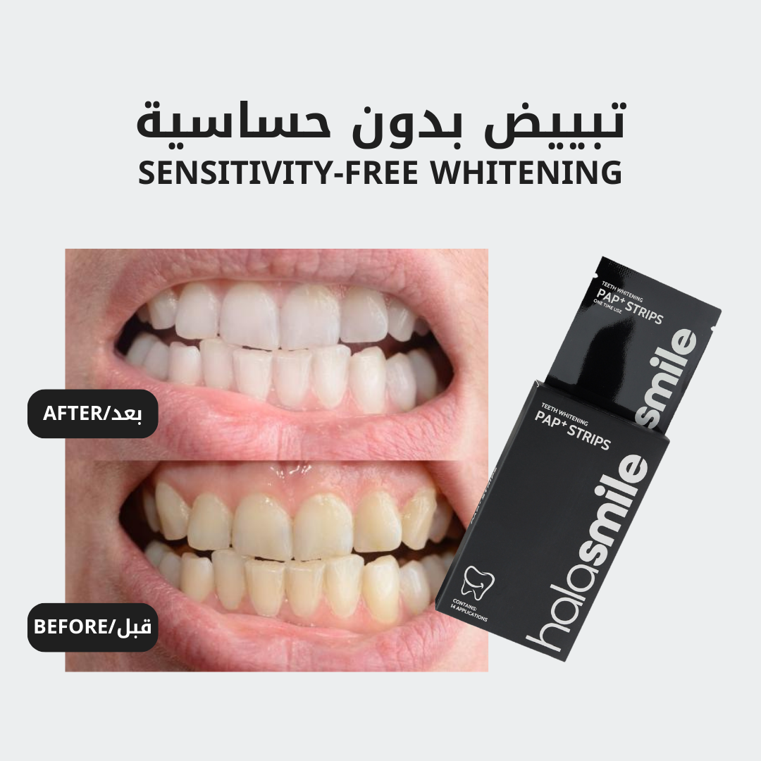 لصقات تبييض الأسنان