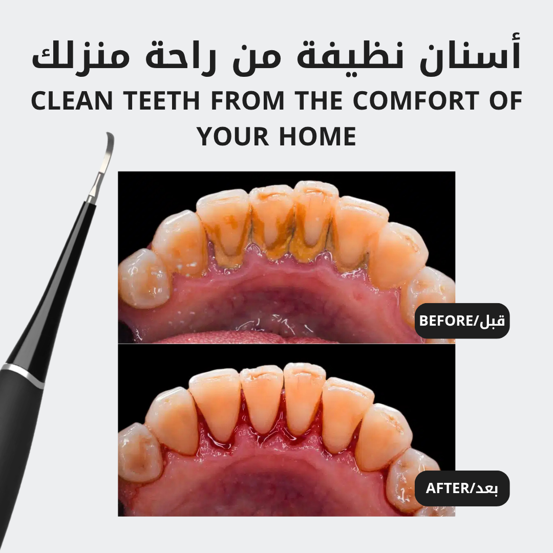 باقة ٢ - جهاز إزالة الجير