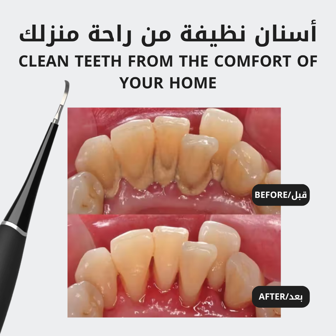 جهاز إزالة الجير