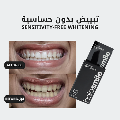 لصقات تبييض الأسنان