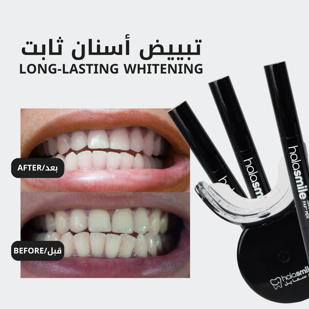 The Teeth Whitening Device – Halasmile™ Kuwait